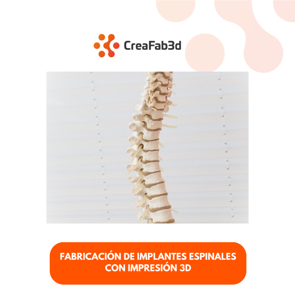 implantes espinales con impresión 3d