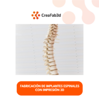 Implantes Espinales con Impresión 3D